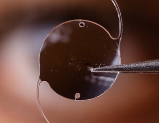 Nahaufnahme einer runden, transparenten Linse mit zwei kleinen Löchern, gehalten von einer Pinzette.